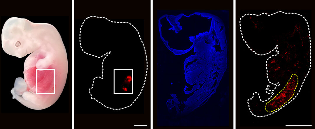 In A 1st, Scientists Grow Human Kidneys Inside Developing Pig Embryos