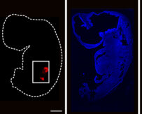 In A 1st, Scientists Grow Human Kidneys Inside Developing Pig Embryos